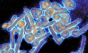 Loại virus gây tử vong cao bùng phát tại Rwanda