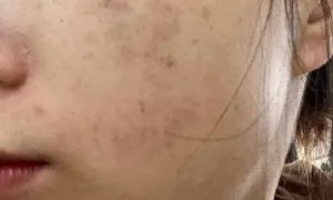 Nhanh già sau 'dao kéo' nâng cấp nhan sắc